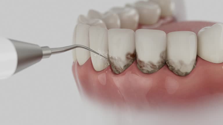 Trusted Teeth Cleaning And Checkup service in Cambridge City, IN - Dentist Open Now